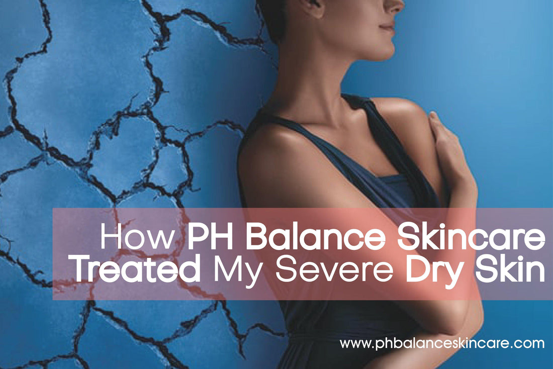 How PH Balance Skincare Treated My Severe Dry Skin - pH Balance Skincare